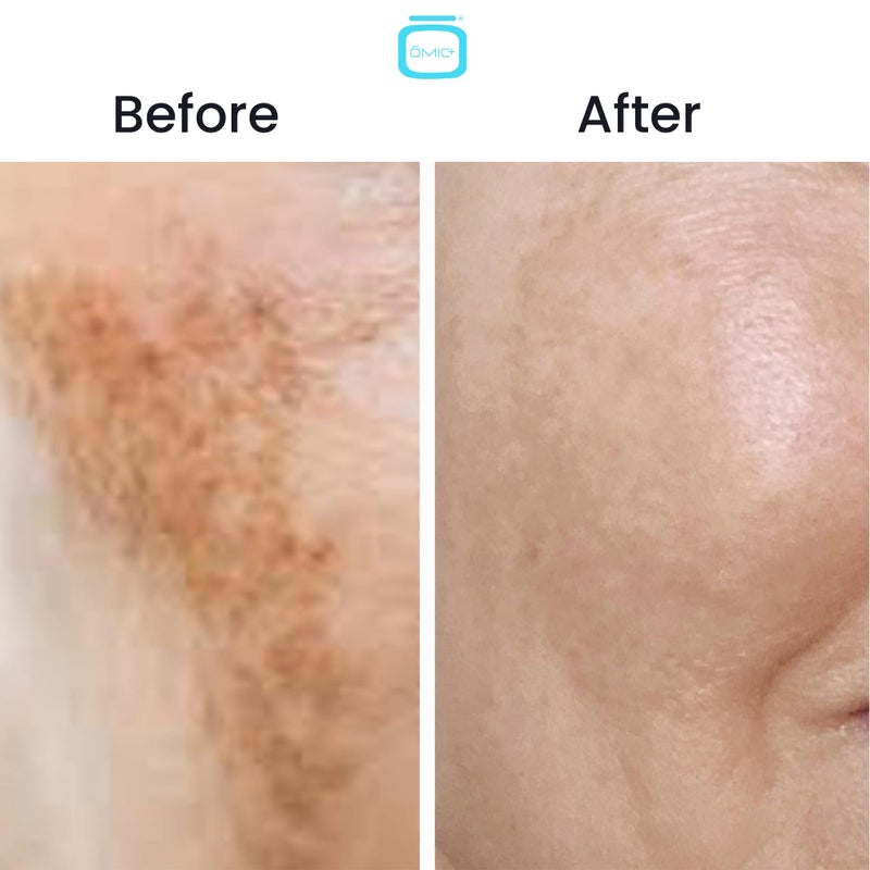 OMIC 10% Tranexamic Acid Cream â€“ 1 fl oz / 30ml â€“ Skin Brightening Cream, Reduce Appearance of Dark Spots, Skin Moisturizer, Even Skin Tone with Coconut Oil & Vitamin E - Image 3