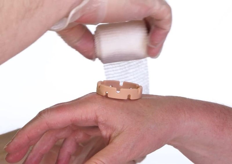 Jokari Healing Spacers 3 Pack for Small Scrapes Scratches or Burns Place Medical Grade Silicone Ring Around Affected Area Wrap With Bandage Secure With Tape to Allow for Airflow and Faster Healing - Image 1