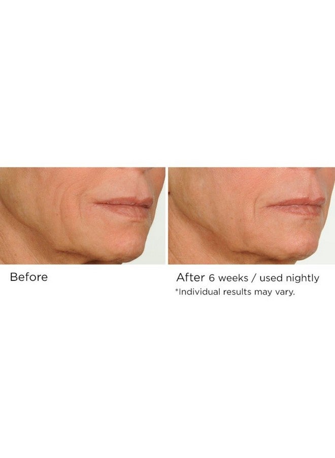 nassif md Nassifmd Night Therapy Serum - Image 4