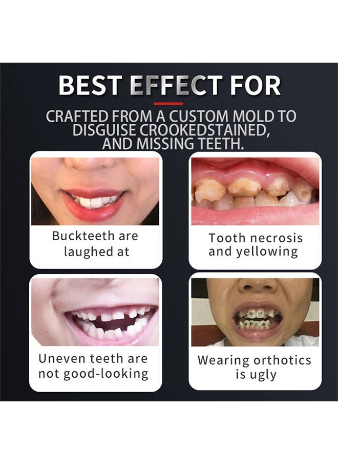 Crazylife Denture Teeth, Fake Teeth Snap On Veneers Dentures Teeth for Upper and Lower Jaw, Silicone Non-Porous Braces, Nature and Comfortable, Protect Your Teeth and Regain Confident Smile for Men and Women  - Image 2