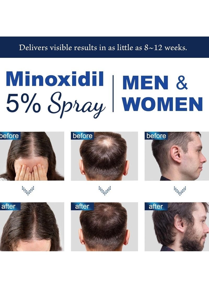 Minoxidil 5% for Men (120 ML), Advanced Minoxidil Spray with Provitamin B5 and Castor Seed Extract, Minoxidil Extract Serum for Hair Loss, Beard Restoration