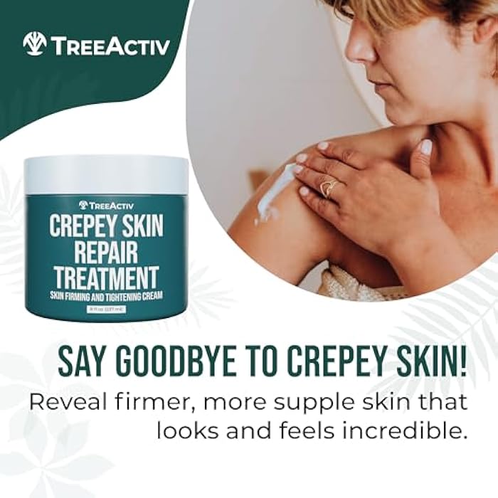 TreeActiv Crepey Skin Repair Cream, 8 oz, Firming Formula with Hyaluronic Acid & Shea Butter to Deeply Moisturize and Tighten Dry, Wrinkly Crepe Skin, 500+ Uses - Image 3