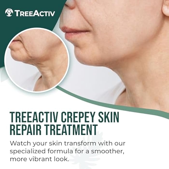 TreeActiv Crepey Skin Repair Cream, 8 oz, Firming Formula with Hyaluronic Acid & Shea Butter to Deeply Moisturize and Tighten Dry, Wrinkly Crepe Skin, 500+ Uses - Image 2