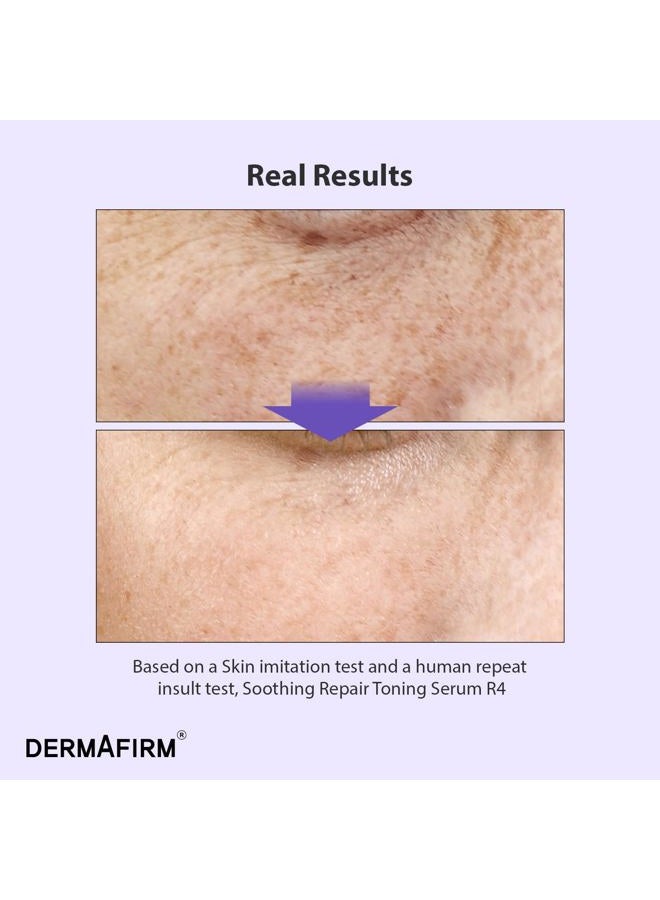 Dermafirm [DERMAFIRM] Soothing Repair Toning Serum R4 | Bakuchiol Face Serum w/Niacinamide & Peptides | Calming and Correcting Facial Serum for All Skin Types | No Animal Trials No Parabens 1.01 fl oz - Image 5