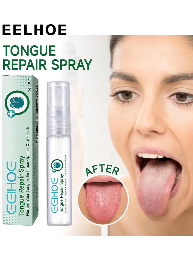 EELHOE Tongue Repair Spray,Mouth Repair Spray Repairs White Tongue Coating, Tongue Care Spray, Portable Mouth Spray, Mouthwash Spray, Freshens Breath, Eliminates Bad Breath 30ml - Image 1