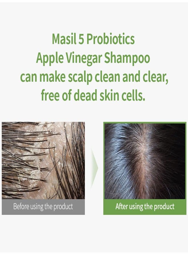 Masil Probiotics Apple Cider Vinegar Shampoo - 5.1floz, Reduces Itchy Scalp, Dandruff and Frizz, Sulfate-Free, Restores Shine with Vitamin E and Optimal pH - Image 5