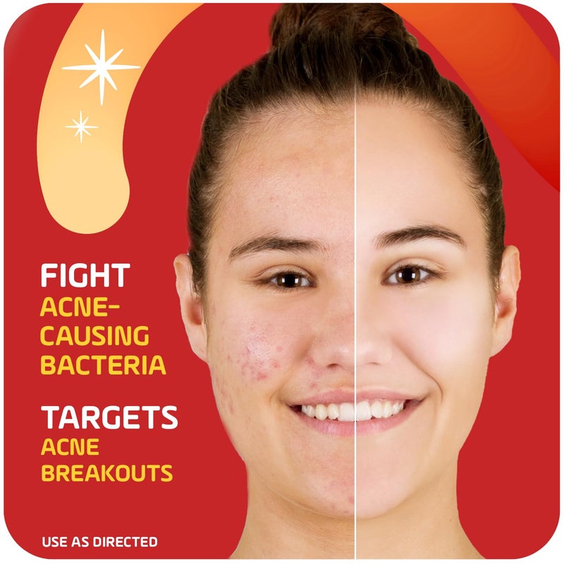 Asepxia 2% Salicylic Acid Acne Spot Treatment Cream | Drying Formula Targets Acne, Clears & Prevents Blemishes, Reduces Redness, Penetrates Pores, Pimple Cream, 1 Oz, 1-Pack - Image 4