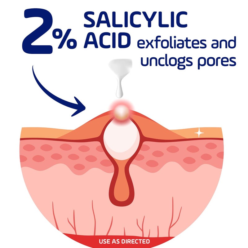 Asepxia 2% Salicylic Acid Acne Spot Treatment Cream | Drying Formula Targets Acne, Clears & Prevents Blemishes, Reduces Redness, Penetrates Pores, Pimple Cream, 1 Oz, 1-Pack - Image 5