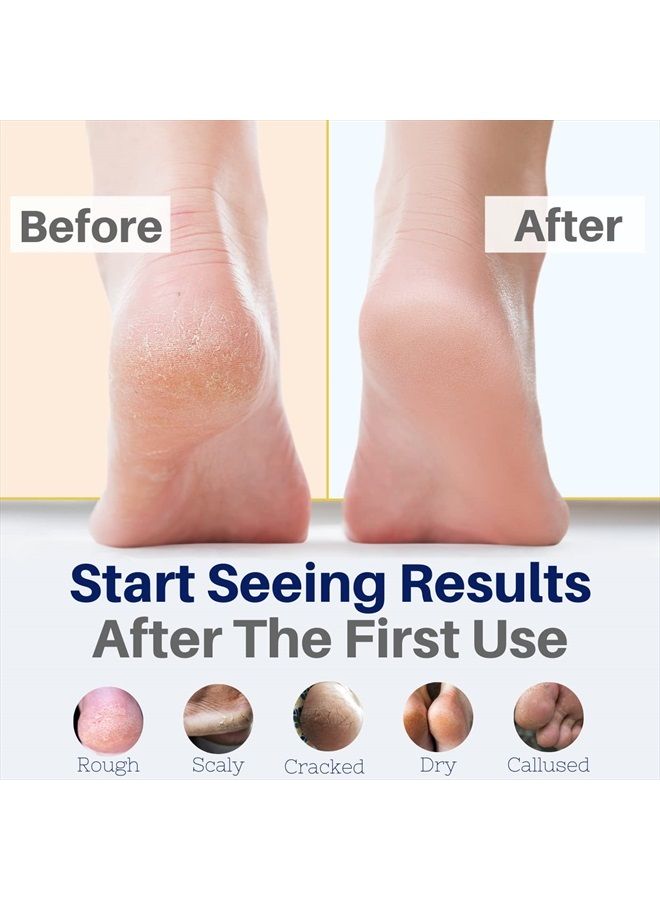 The Yellow Bird Yellow Bird Natural Foot Cream - For Dry and Cracked Feet Repair. Organic Athlete's Foot Balm. Salve Moisturizer for Heel Care & Callus Treatment with Tea Tree Oil & Peppermint Essential Oils - Image 2