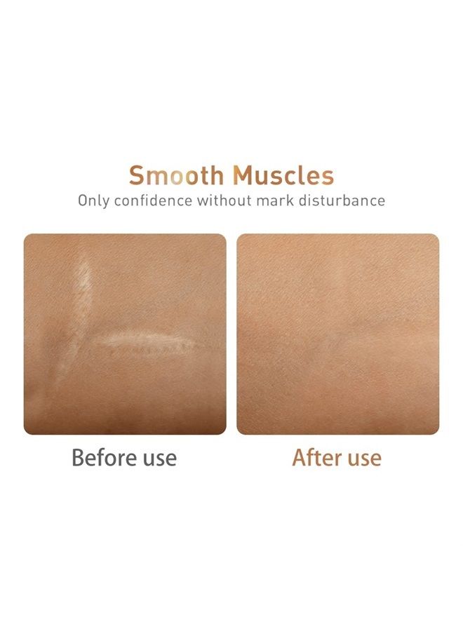LANBENA Scar Removal Stretch Marks Serum, Reduces the Appearance of Scars, Wrinkles, Burns, and Wounds Remove Acne Scar Serum with Natural Herbal Extracts Formula - Image 4