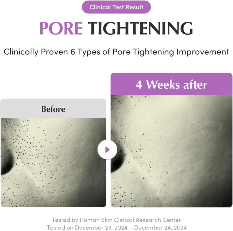 eqqualberry Purple PDRN Pore Minimising Serum - Vegan Collagen & Peptides for Pore Refining & Skin Elasticity | Niacinamide & CICA Exosome for Calming | Korean Glass Skin, 30 ml - Image 4