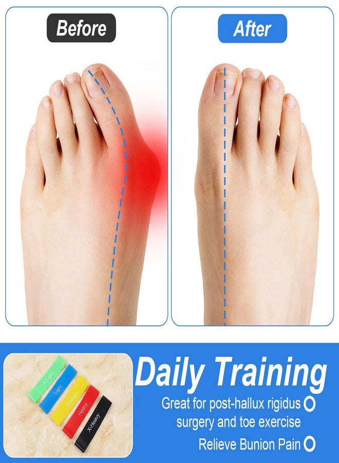 Sibba 5Pcs Toe Resistance Bands Toe Stretcher Bands for Bunion Correction Bunion Relief Toes Strength Foot Exercise Band for Hallux Valgus Yoga Daily Toes Training - Image 4