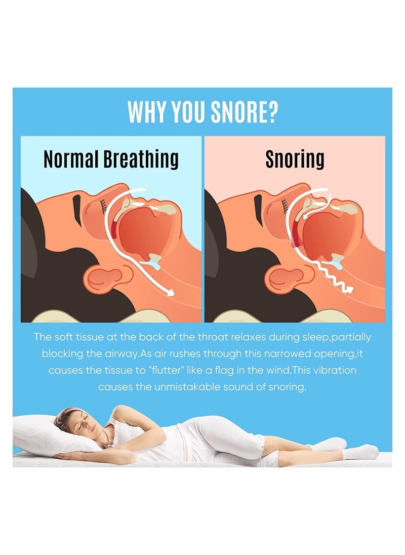 Anti-snoring Mask, anti-snoring device to help stop snoring, snoring reduction solution, comfortable and adjustable for men/women. Give people a good night's sleep