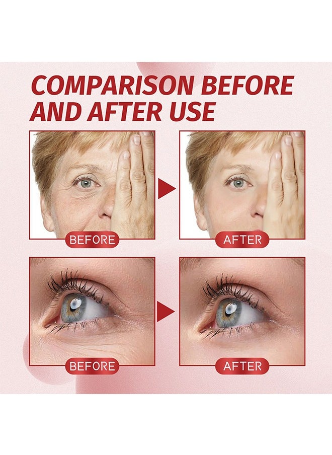 EELHOE - Skin Hydrating Serum,Hydrating Serum for Face, Day/Night Moisturizer with Hyaluronic Acid, Anti Wrinkle Serum w/Anti-inflammatory Compounds 30ml - Image 1