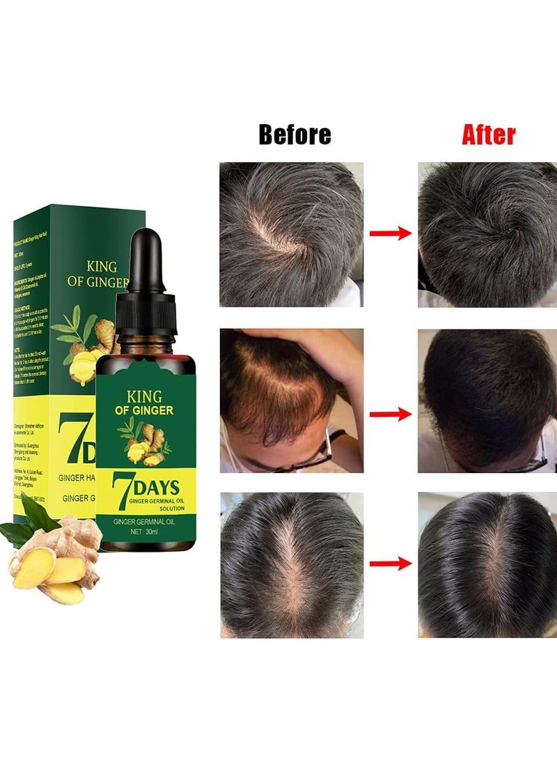 Jaysuing Hair Regrow 7 Day, Ginger Germinal Essential Oil Hair Growth Hair Loss Treatment Hair Care Hair Growth Serum for Men & Women, 30ML - Image 5