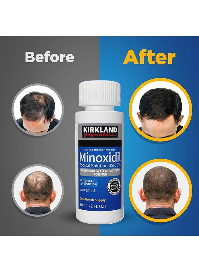 Kirkland Signature 6 Pieces Minoxidil Topical Solution USP, 5%, Extra Strength Hair Regrowth Treatment For Men  - Image 2