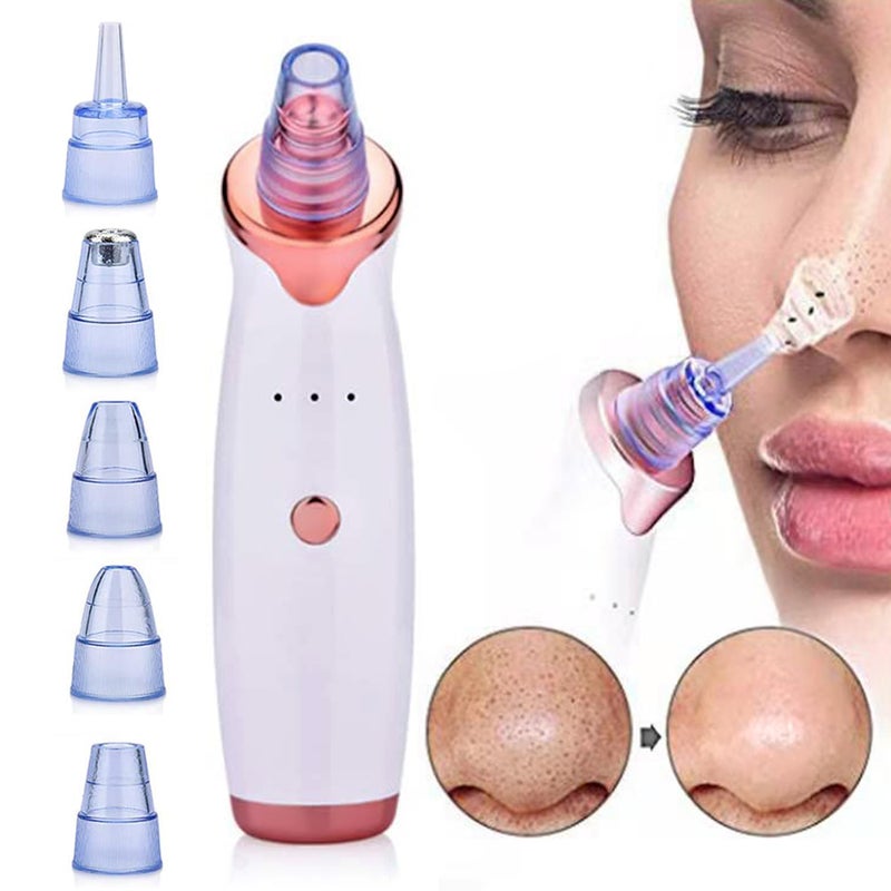 Blackhead Remover Blackhead Suction Equipment Electric Blackhead Suction Pore Cleaner Beauty Equipment White - Image 1