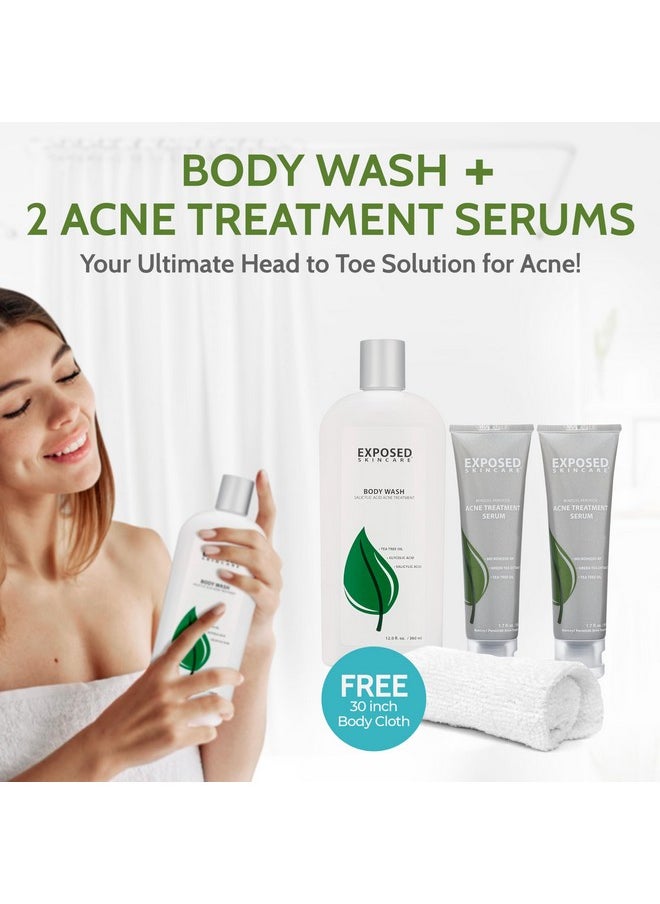Exposed Skin Care - Body Acne Kit Dual Acne Treatment Serums + Body Wash And Exfoliating Body Cloth Powerful System Eliminates Pimples And Breakouts To Quickly Clear Back And Body Acne - Image 1