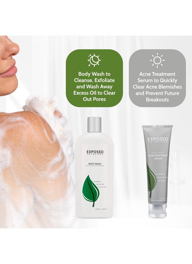 Exposed Skin Care - Body Acne Kit Dual Acne Treatment Serums + Body Wash And Exfoliating Body Cloth Powerful System Eliminates Pimples And Breakouts To Quickly Clear Back And Body Acne - Image 1