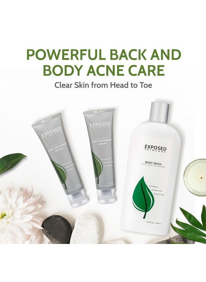 Exposed Skin Care - Body Acne Kit Dual Acne Treatment Serums + Body Wash And Exfoliating Body Cloth Powerful System Eliminates Pimples And Breakouts To Quickly Clear Back And Body Acne - Image 1