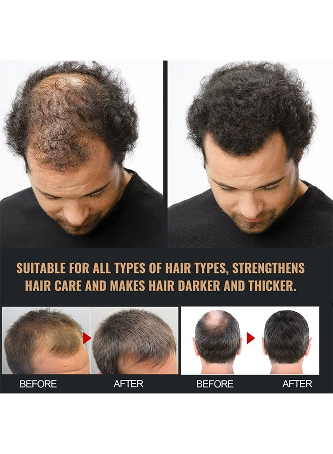 إيلهو شامبو تنشيط الجذور يقوي جذور الشعر المضادة للشعر والشعر الكثيف والرقيق وشامبو ناعم وقوي لإصلاح الشعر والعناية به - Image 5