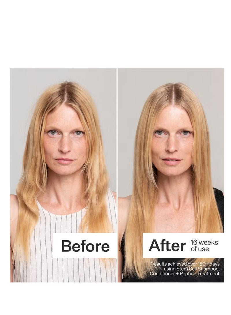 Act+Acre Stem Cell Conditioner for Hair Thinning and Growth 295ml - Image 2