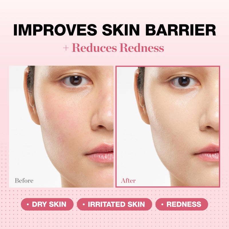 Physiogel Redness Reducing Cream â€“ Ceramide Moisturizer for Dry, Sensitive & Redness-Prone Skin, Repairs Skin Barrier, Dermatologist-Tested, Fragrance-Free, Korean Skincare, 1.69 fl oz - Image 2
