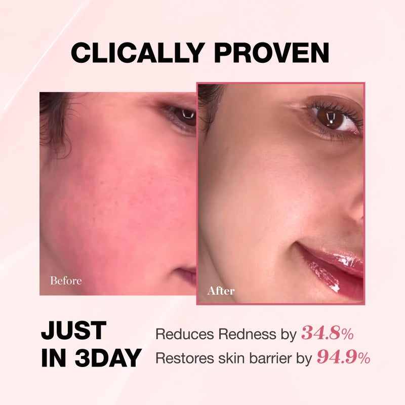 Physiogel Redness Reducing Cream â€“ Ceramide Moisturizer for Dry, Sensitive & Redness-Prone Skin, Repairs Skin Barrier, Dermatologist-Tested, Fragrance-Free, Korean Skincare, 1.69 fl oz - Image 4