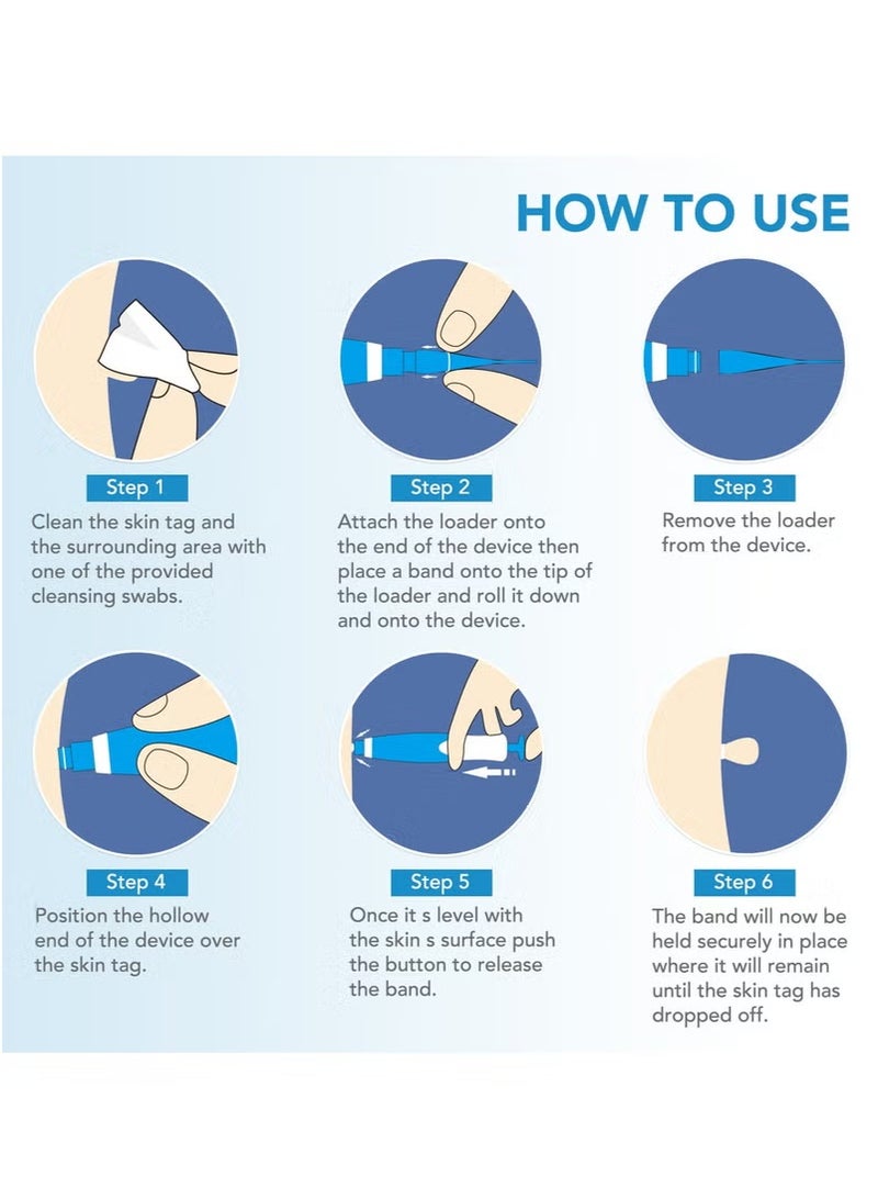 Sefudun Wart Removal Tool Skin Tag Removal Double Head - Image 2