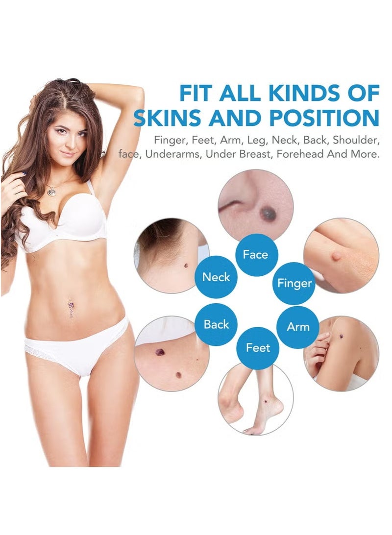 Sefudun Wart Removal Tool Skin Tag Removal Double Head - Image 3