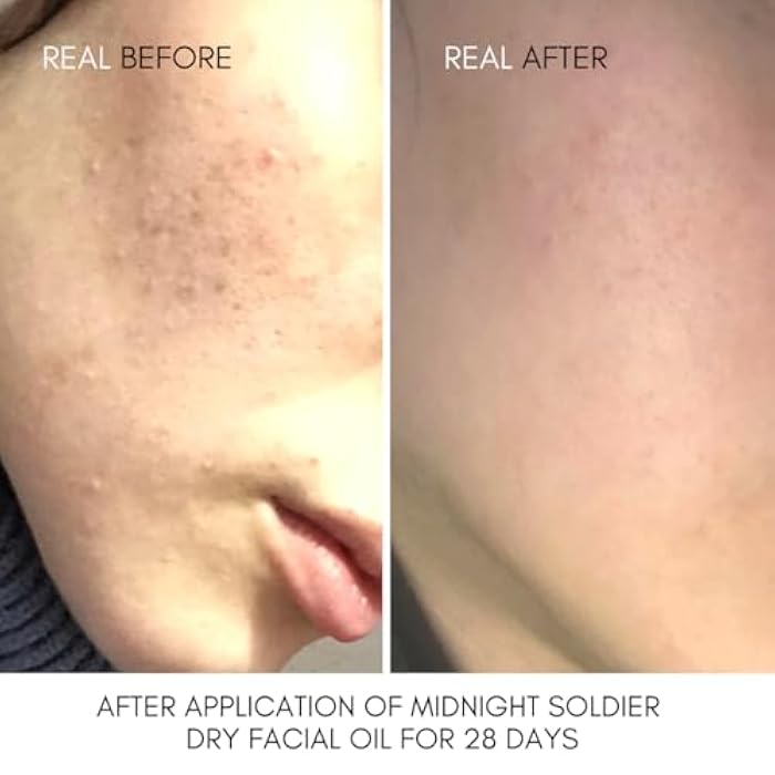 NUT Botanicals Midnight Soldier Facial Oil 30 ml - Image 2