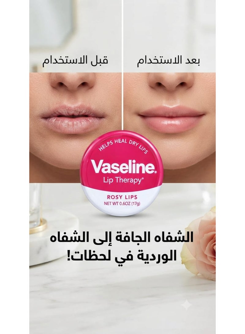 فازلين مرطب شفاه ليب ثيرابي روزي ليبس 17 جم (قد تختلف العبوه) - Image 2