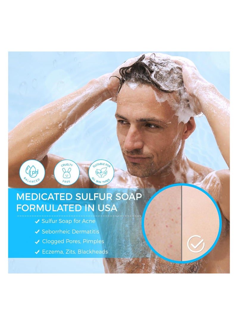 OUKEYA Sulphur Soap Cleansing Bar for Face & Body Natural Sulfur Facial Cleanser With Salicylic Acid Goat Milk and Tea Tree Oil for Acne-Prone Skin - Image 2
