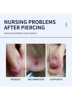 MELAO Piercing Aftercare Spray，Piercing Bump Solution，Keloid Shrinking for Ear，Belly， Nose，Piercing Aftercare， All Natural and Gentle Ingredients （60ml）  - Image 5