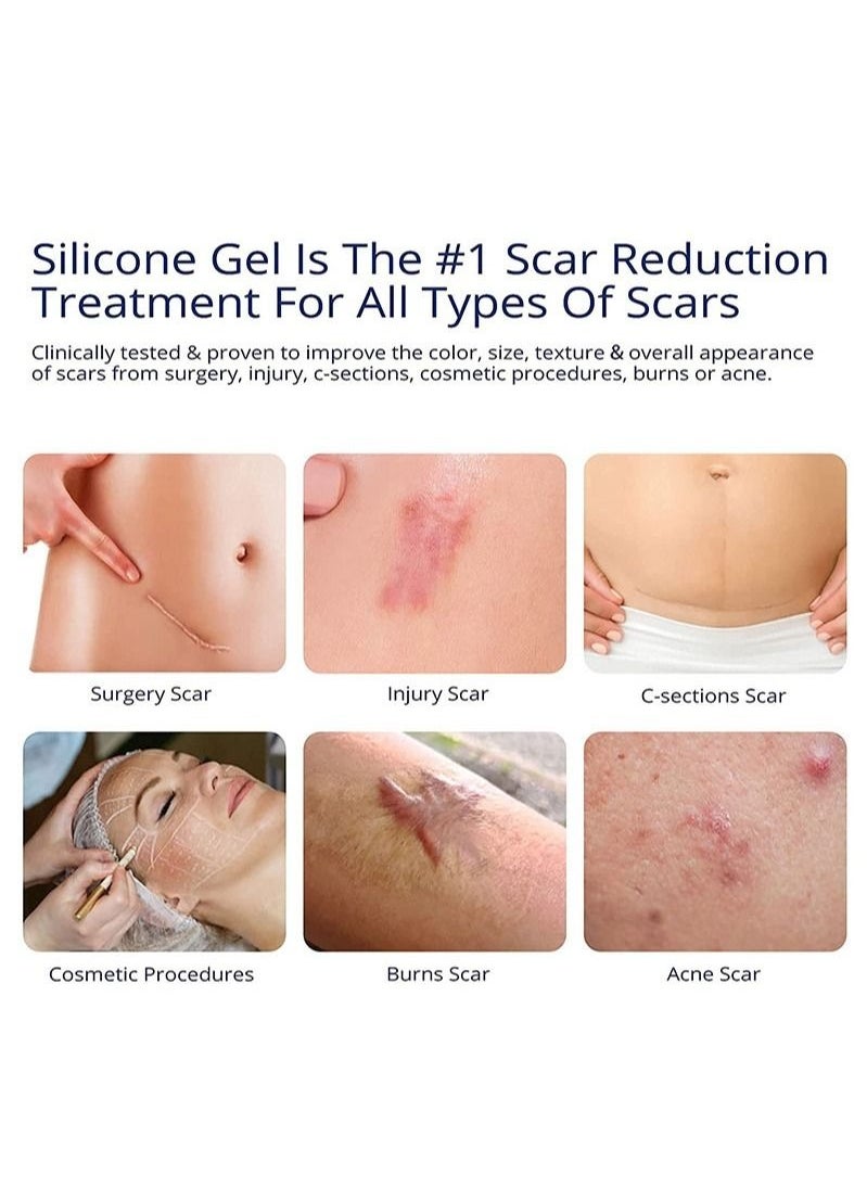 ASMOXA 100% جل سيليكون لعلاج الندوب - جل متقدم للندوب الجراحية، ولادة قيصرية، علامات تمدد الجلد، حب الشباب، إصابات، حروق، كيلود، الندوب القديمة والجديدة 1.06 أونصة (30 جرام)  - Image 5