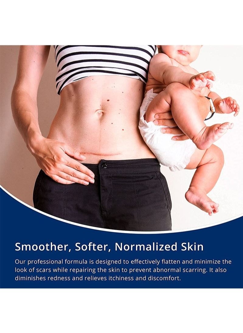 ASMOXA 100% جل سيليكون لعلاج الندوب - جل متقدم للندوب الجراحية، ولادة قيصرية، علامات تمدد الجلد، حب الشباب، إصابات، حروق، كيلود، الندوب القديمة والجديدة 1.06 أونصة (30 جرام)  - Image 3