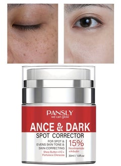 Acne and Dark Spot Corrector Dark Spot Remover Cream for Face and Body Dark Spot Corrector Treatment Enriching Skin Care for All Skin Tones Anti Aging  Acne Scar Removal Whitening Cream 30ml