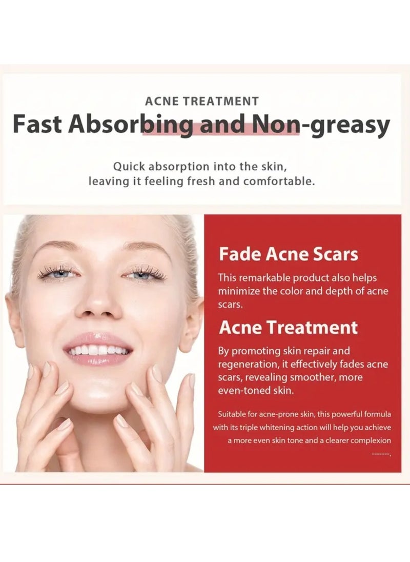 PANSLY - Acne and Dark Spot Corrector Dark Spot Remover Cream for Face and Body Dark Spot Corrector Treatment Enriching Skin Care for All Skin Tones Anti Aging  Acne Scar Removal Whitening Cream 30ml - Image 1