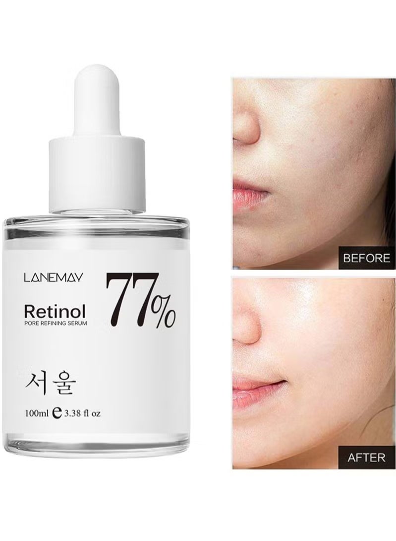 LANEMAY 77% Retinol Pore Refining Serum,Anti-Aging Power Essence,Hydrating Firming Essence For Face With Filtrate Wrinkle Reduction,Age Spot and Post Acne Effects for Dull and Dry Skin,Korean Skin Care-100ml - Image 1