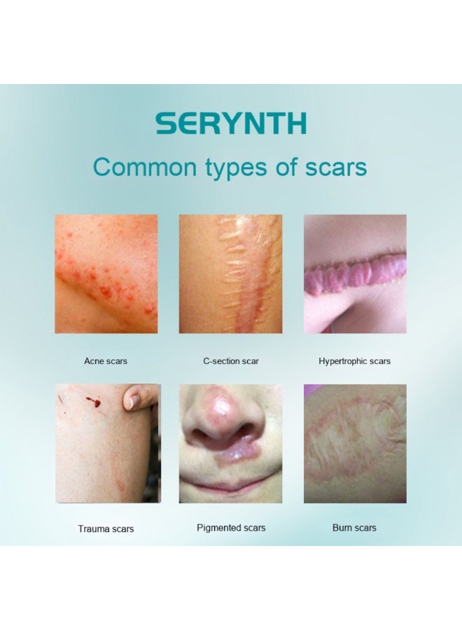 SERYNTH Scar Treatment Cream Scar Gel Helps Soften And Flatten Scars For New And Old Scars Gentle And Non-irritating 20g - Image 2