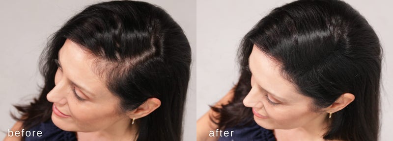 LUXE Professional LUXE Hair Building Fibers - Thickening Fibers - CONFIDENCE IN A JAR â€“ 2 Months+ Supply! â€“ Hypoallergenic, Dermatologist Tested â€“ Multiple Colors Available (Dark Brown) - Image 3