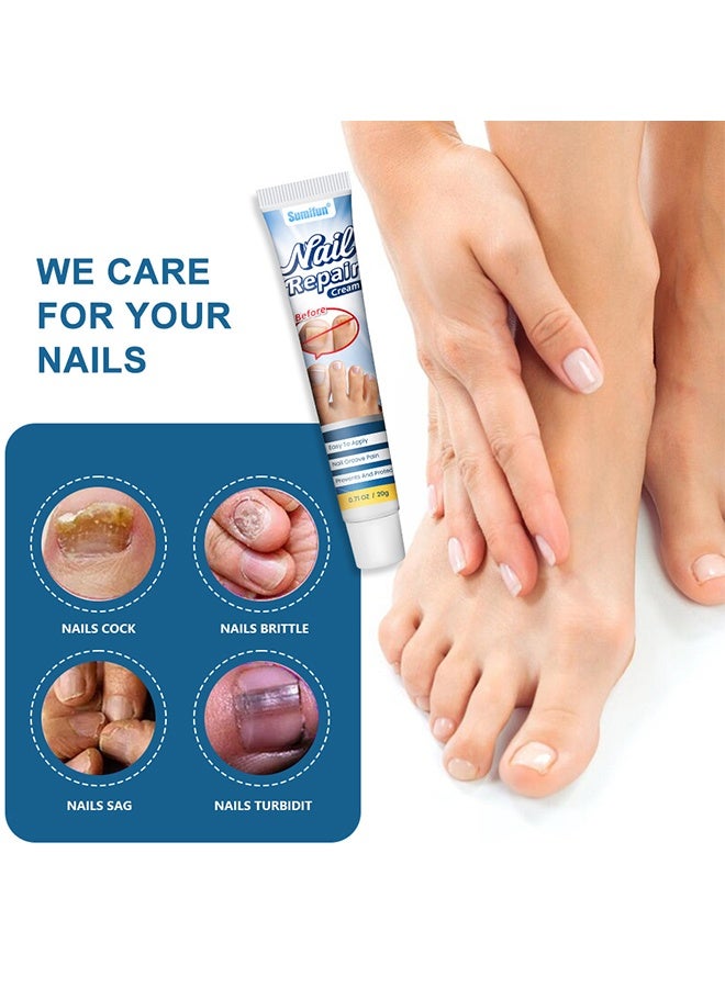 Sumifun Nail Repair Cream - Nail Toe Cream, Nail Cream Anti Harmful Substances Repair Finger Toe Nail Care Perfect for Men and Women Home Use 20g - Image 2