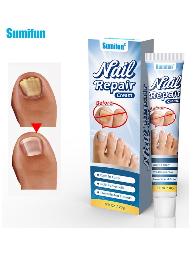 Sumifun Nail Repair Cream - Nail Toe Cream, Nail Cream Anti Harmful Substances Repair Finger Toe Nail Care Perfect for Men and Women Home Use 20g - Image 4