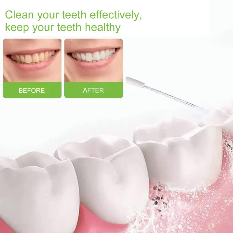 Tooth flusher electric pulse cleaning instrument strong water pressure tooth cleaning device dental floss cleaning teeth household portable dental flushing device light green - Image 5