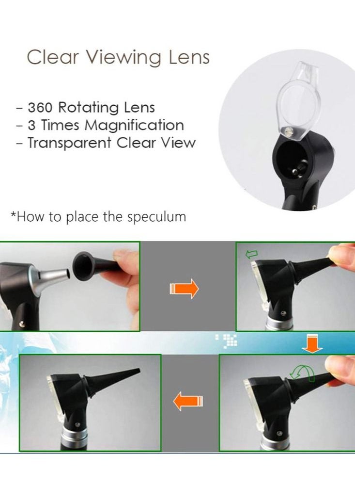 Joshberg - Ear Otoscope Magnification Diagnostic Ear Scope with LED Direct Lllumination Light - Image 1