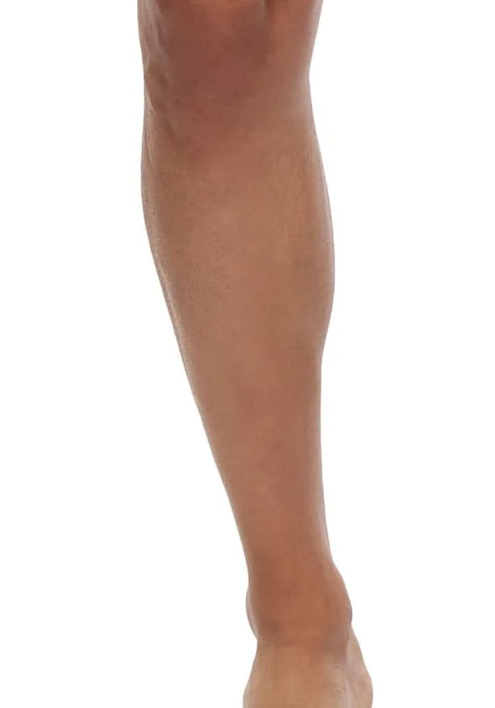 نيفيا Nivia Orthopedic Patella Support - Adjustable Free Size