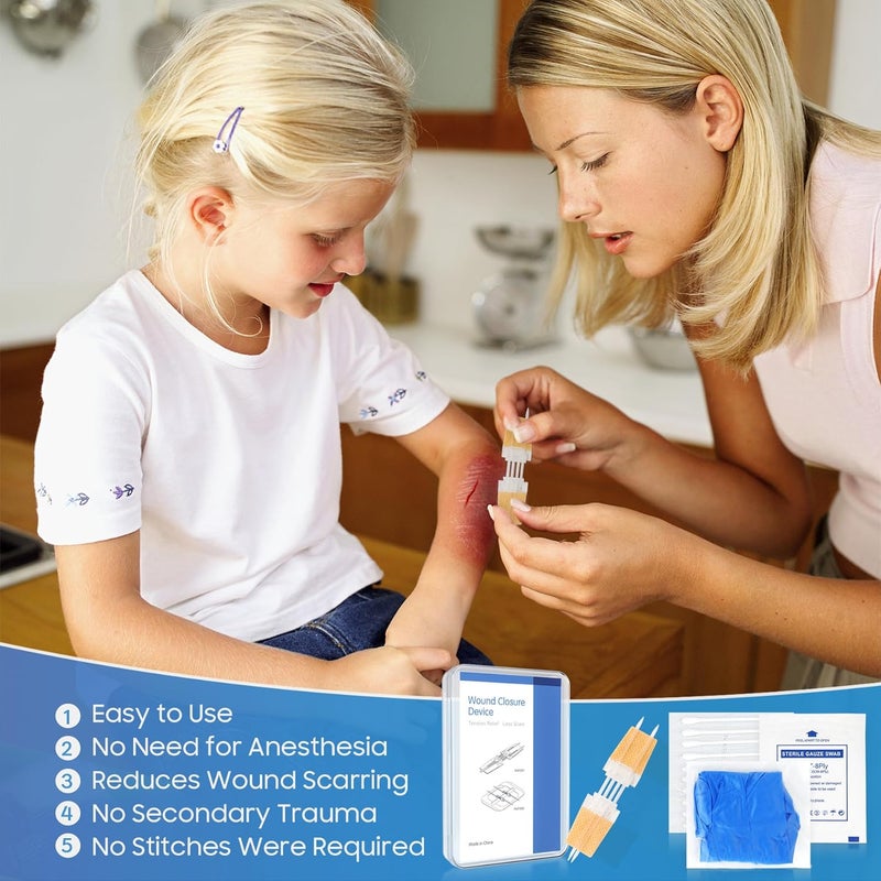 SEABIRD Zip Stitch Wound Closure Kit Butterfly BandagesQuick Clot for Easy Use Surgical QualityEmergency Laceration Closures Strips SutureFree Surgical Repairment First Aid Wound Care Yellow 4 - Image 4
