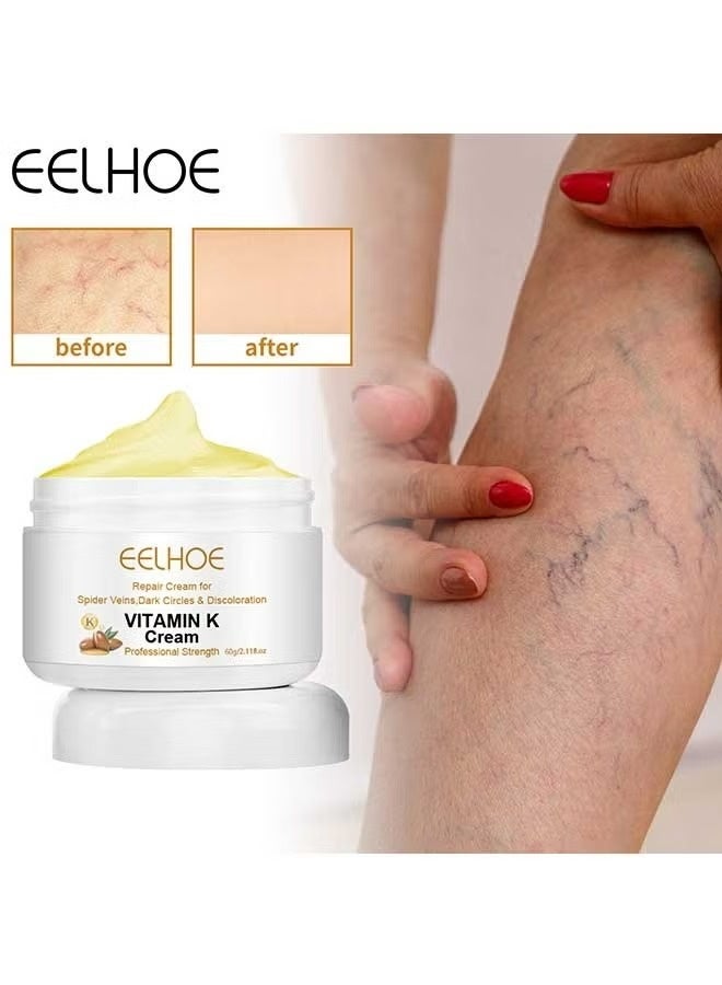EELHOE Vitamin K Varicose Veins Cream, Soothing Leg Cream, Varicose and Spider Veins Treatment Cream, Improve Blood Circulation, Fast Relieve Swelling Pain 60g - Image 1