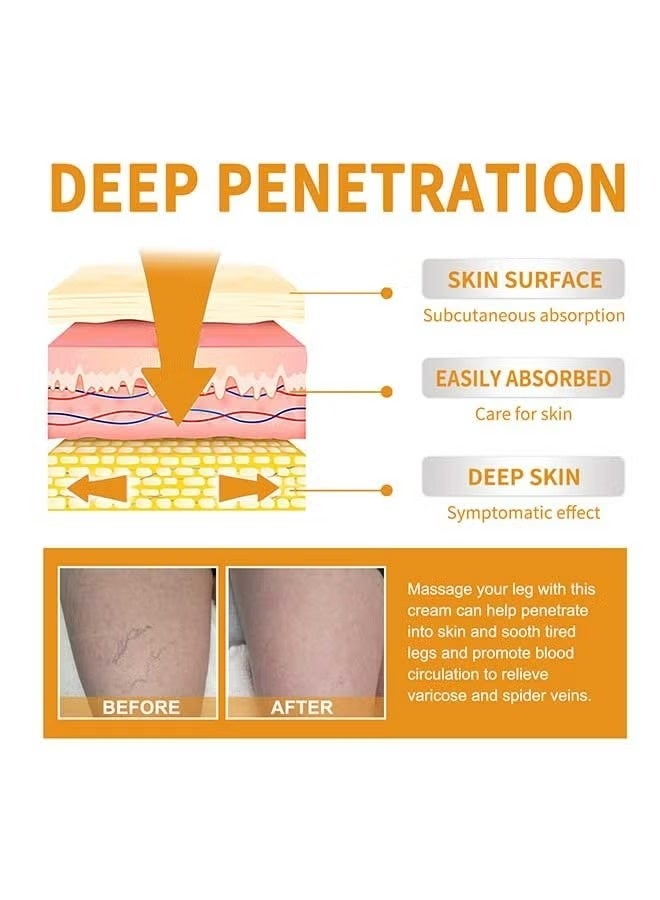 EELHOE Vitamin K Varicose Veins Cream, Soothing Leg Cream, Varicose and Spider Veins Treatment Cream, Improve Blood Circulation, Fast Relieve Swelling Pain 60g - Image 4