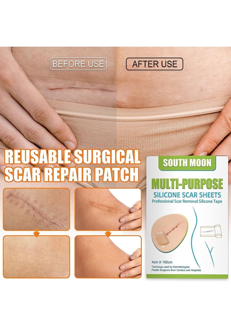 SOUTH MOON Multi Purpose Silicone Scar Sheets Medical Grade Silicone Roll -150cm,Silicone Scar Tape Keloid,C-Section,Surgical Scars Removal Scar Roll Silicon Gel Cream Patch Removes Abs Tuck Surgery Scars Scar Removal Strips  - Image 4